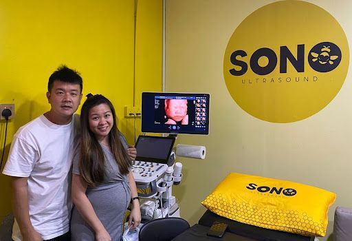 SONOBEE ULTRASOUND BUKIT SENTOSA
